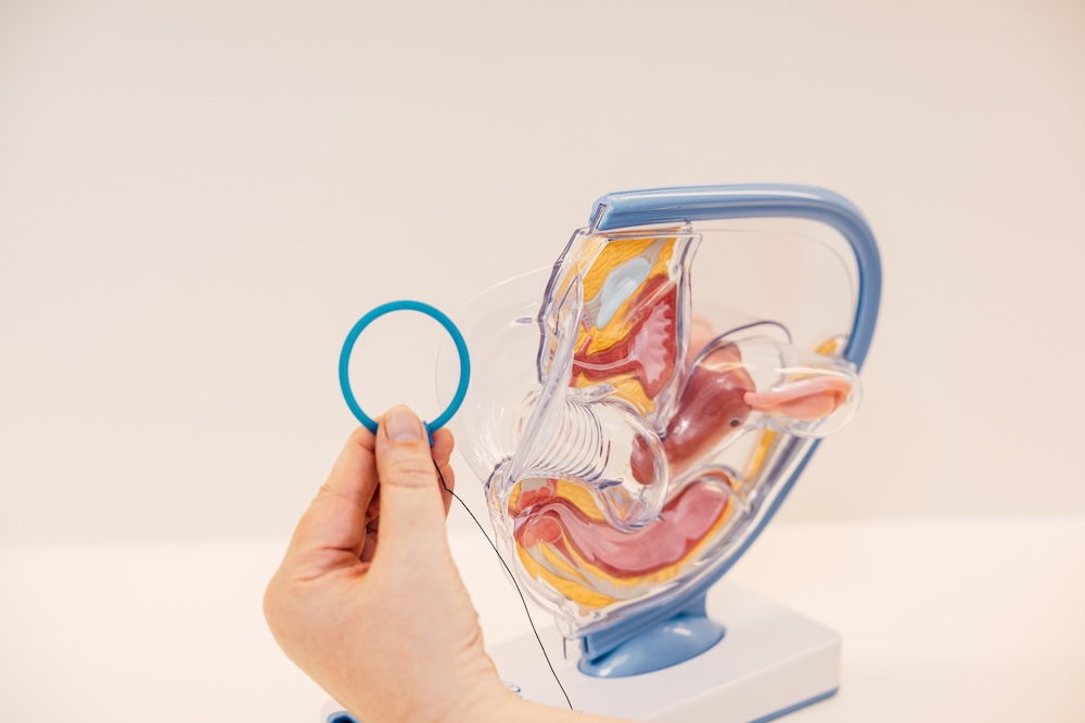 Hand hält einen Verhütungsring vor einem anatomischen Modell des weiblichen Beckens